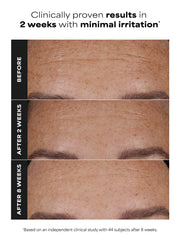 PRO Retinaldehyde Dual-Retinoid Treatment